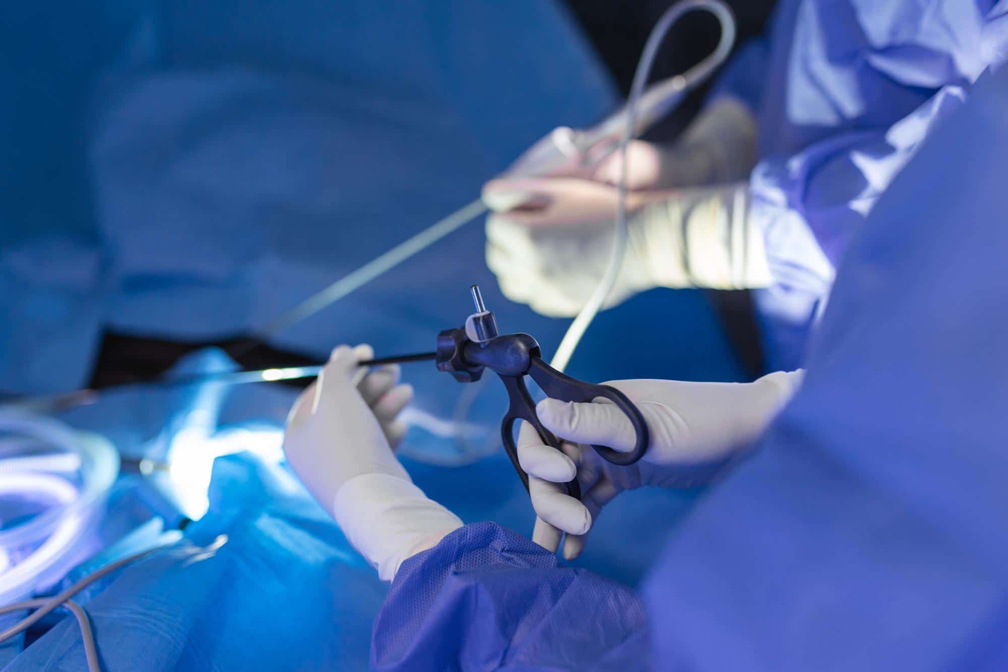 liposukcja lipedemy